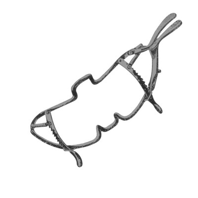 Whitehead Mouth Gag